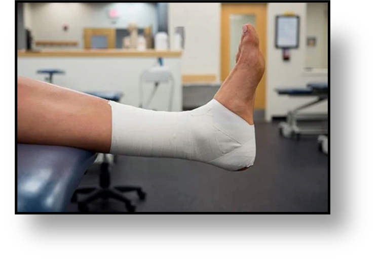 Ankle Tape Job Picture.png