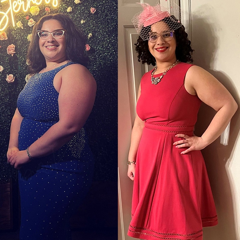 michalyn-before-and-after-bariatric-surgery-800x800.jpeg
