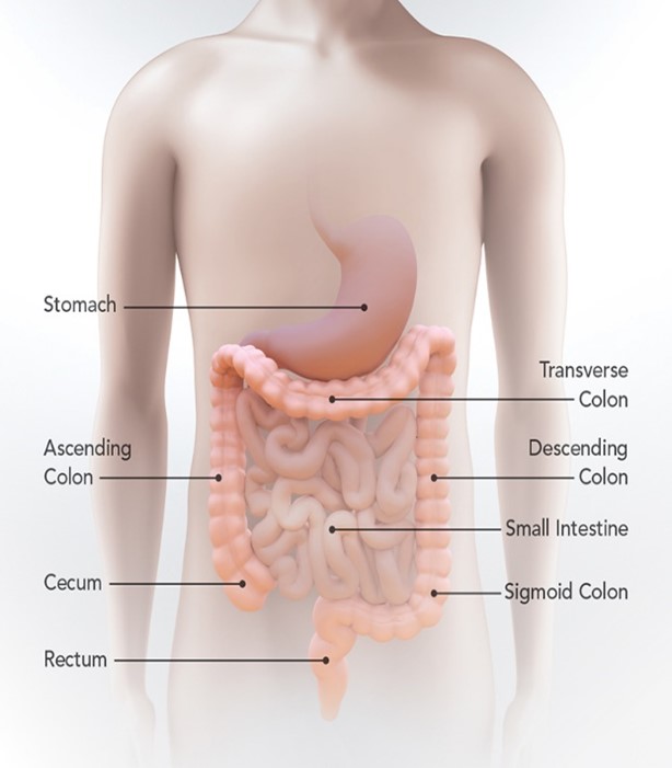 colorectal-cancer.jpg